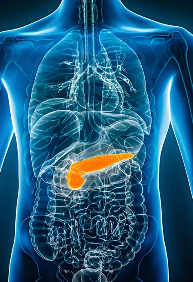 Pancreas Cancer Surgery