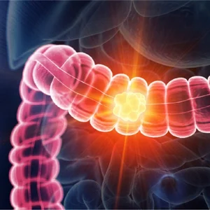 Inflammatory conditions