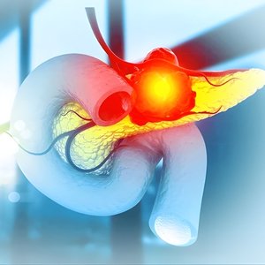 Chronic pancreatitis