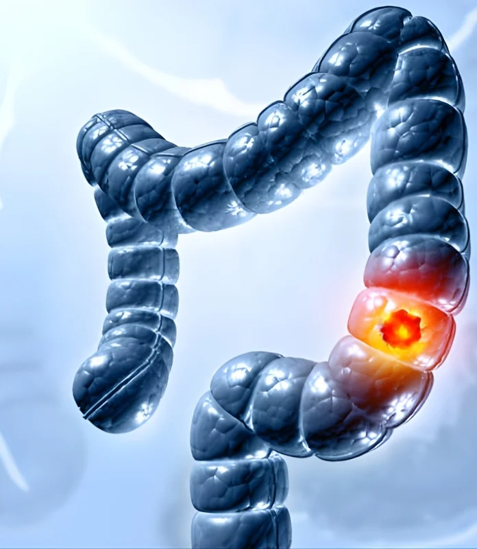 Gastrointestinal-Origin Cancers