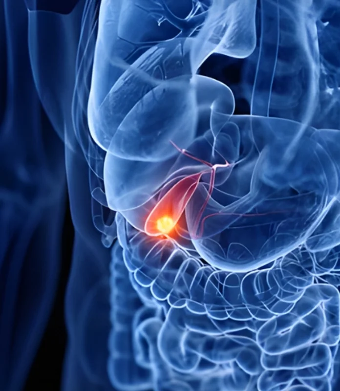 Gall Bladder Cancer