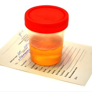 Blood in urine