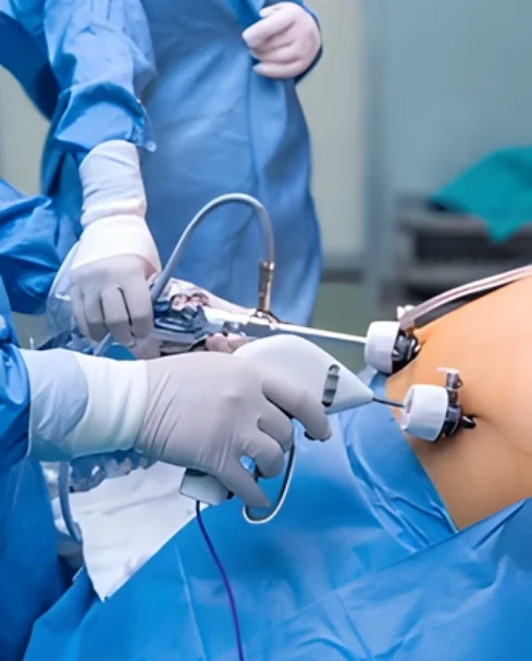 Minimally Invasive Surgery