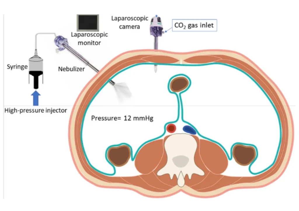 Pressurized Aerosol Delivery