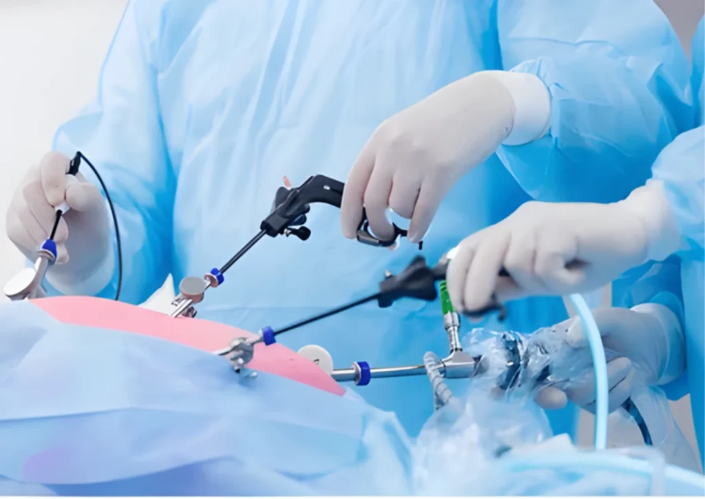 Laparoscopic Surgery