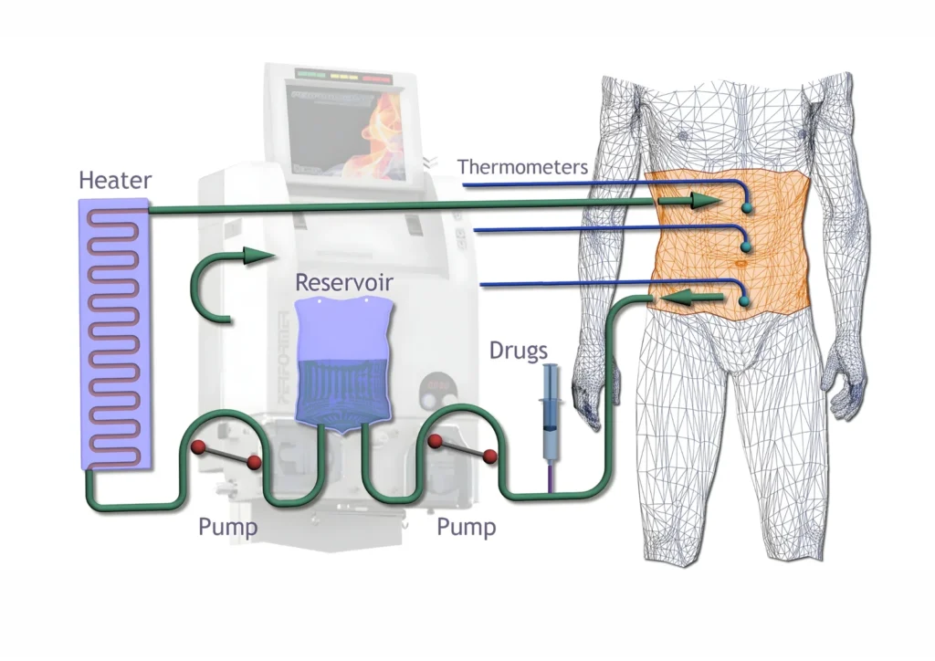Targeted Local Therapy Advantage