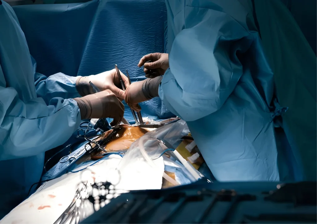 Minimally Invasive Surgery