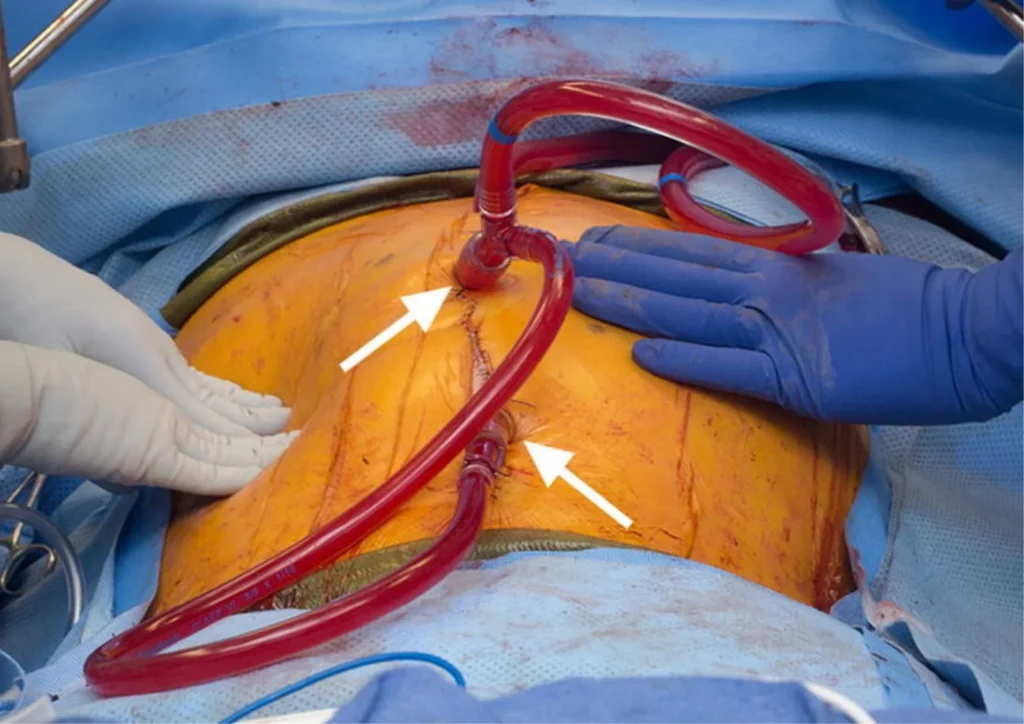 Precision-Based Techniques