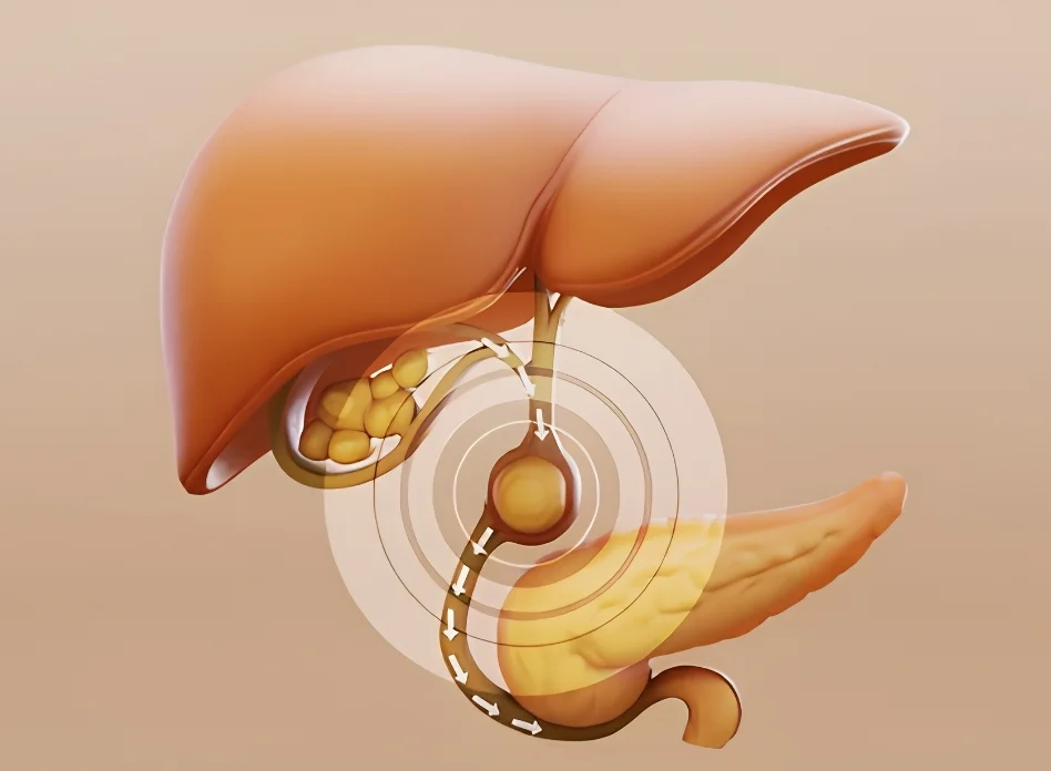 Gallbladder disorders