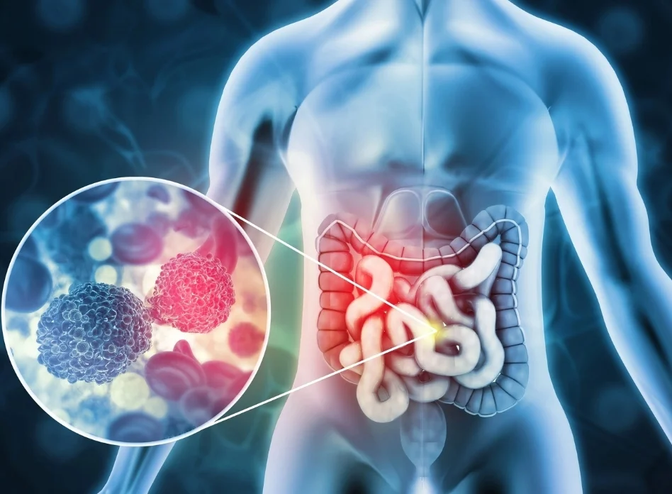 Gastrointestinal cancers (colon, rectum, stomach)
