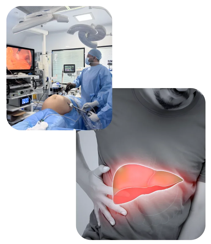 Liver Cancer